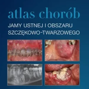 Atlas chorób jamy ustnej i obszaru szczękowo..