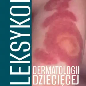 Leksykon dermatologii dziecięcej Tom II